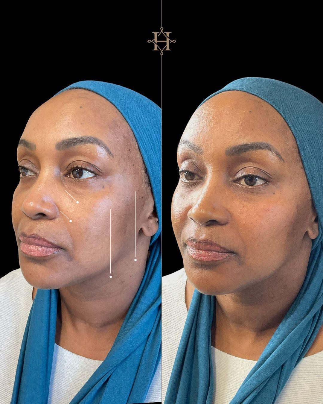 anti-aging-BA-1