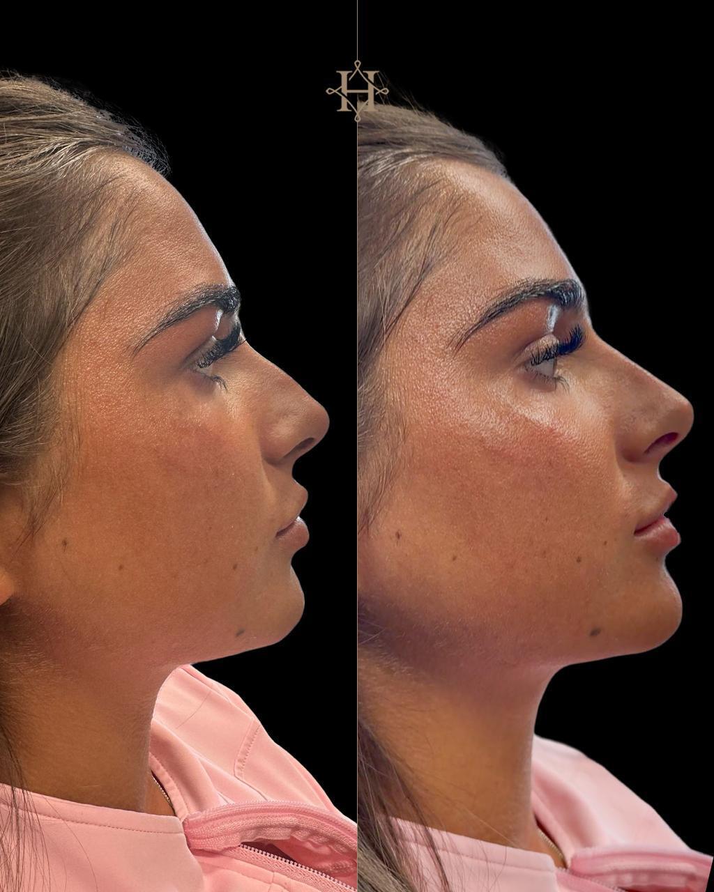 anti-aging-BA-2