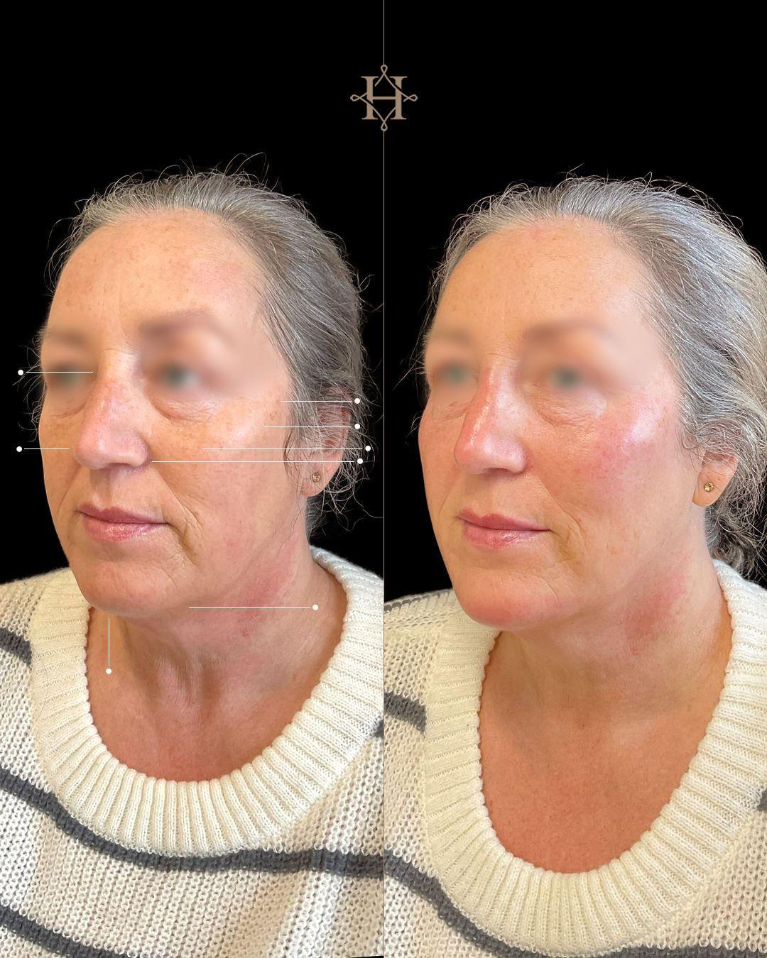 anti-aging-BA-3