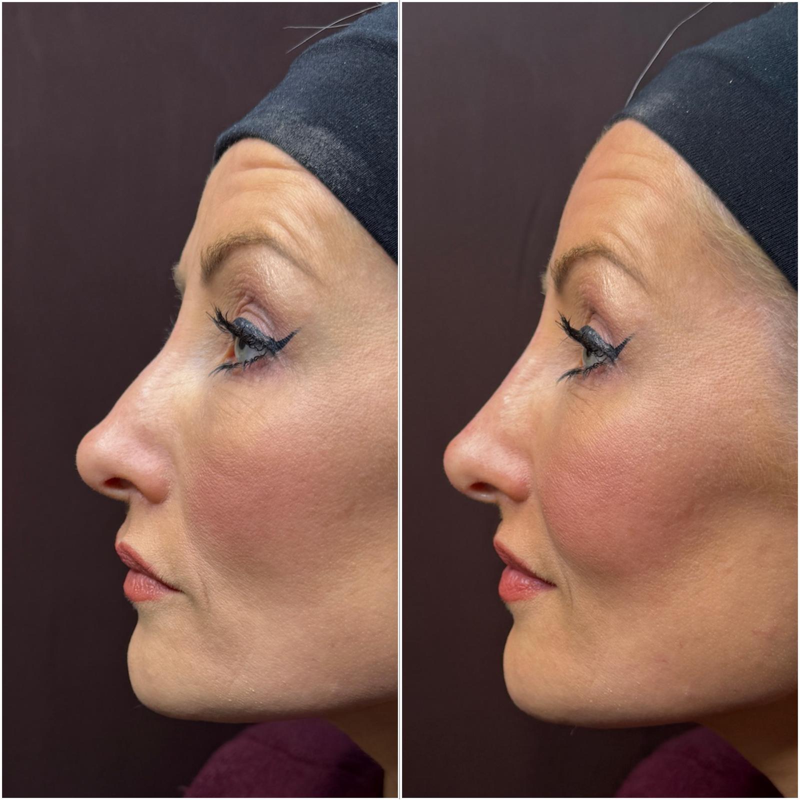 anti-aging-BA-5