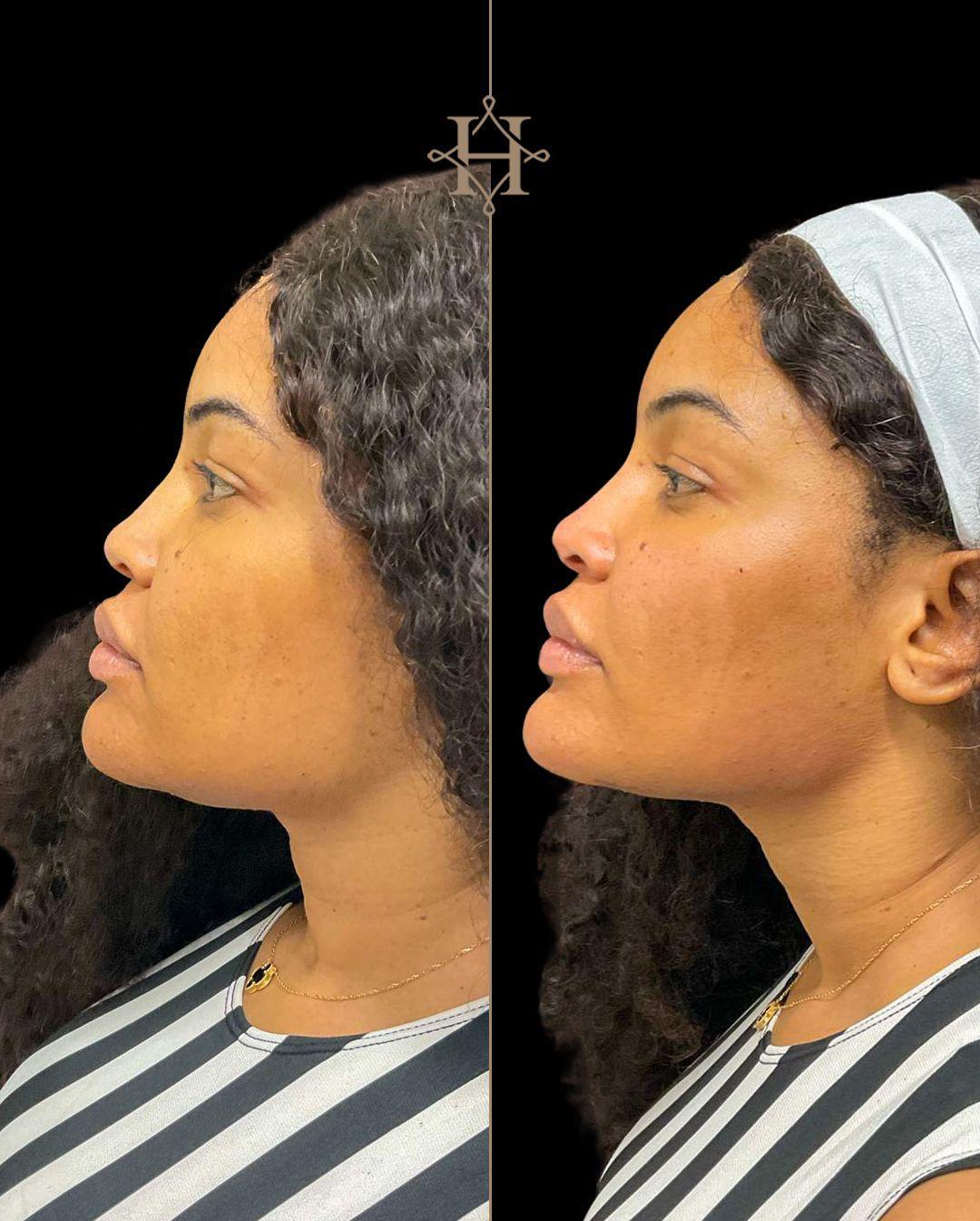 anti-aging-BA-6