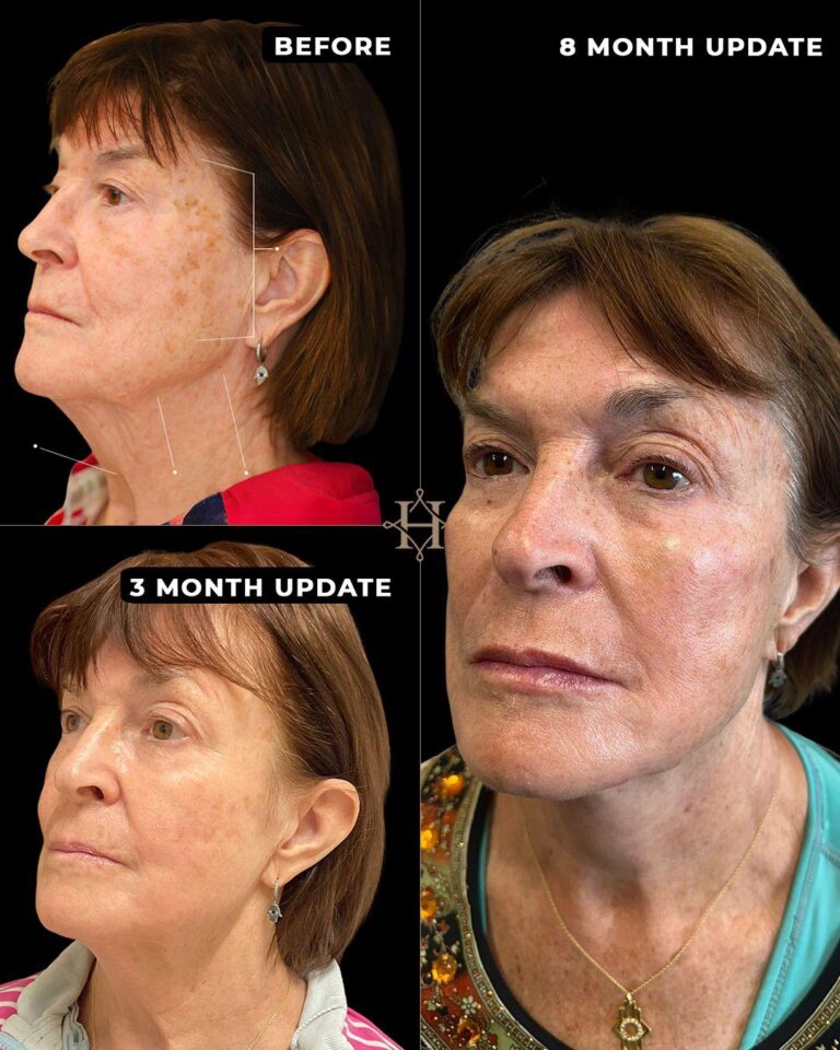 WhatsApp Image 2025-08-12 at 05.08.57