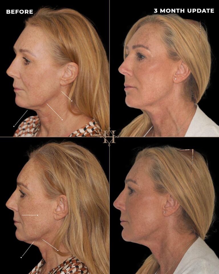 WhatsApp Image 2025-08-12 at 05.08.58 (1)